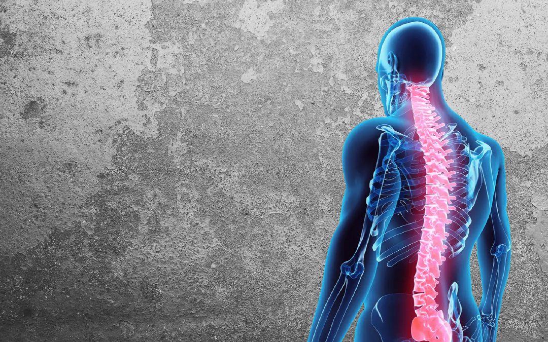 Backbone Pain Relief winter park chiropractic