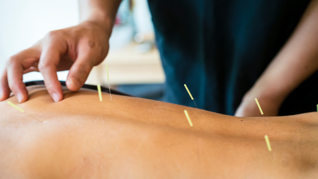 acupuncture Holistic Approach to Healing | Winter park Chiropractic