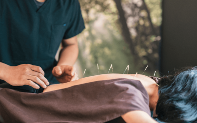 The Benefits of Acupuncture Near Me and Chiropractic Care in Orlando