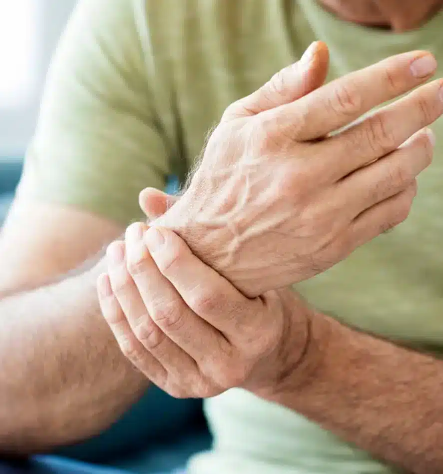 Osteoarthritis, Rheumatoid Arthritis