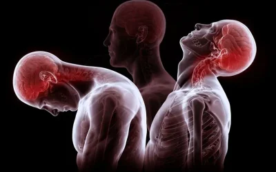 Personal Injury Chiropractic