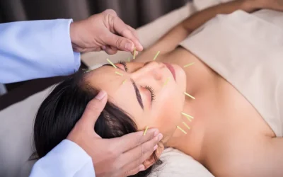 Acupuncture Near Me – Restoring Balance and Wellness