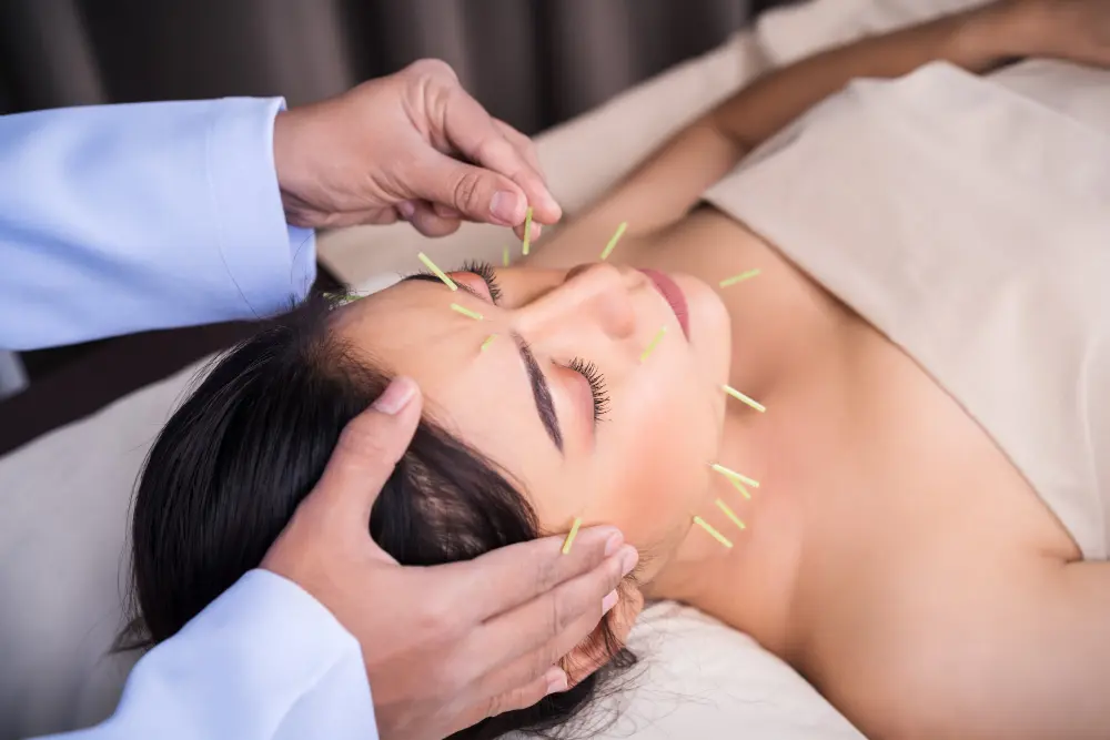 Acupuncture Near Me