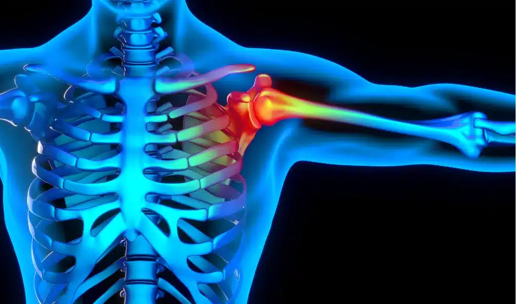 Shoulder Pain Chiropractor Near Me