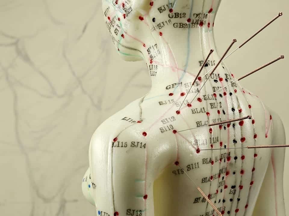 Acupuncture Near Me