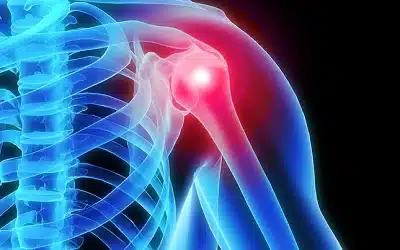 Shoulder Pain Chiropractor – Expert Care at Winter Park