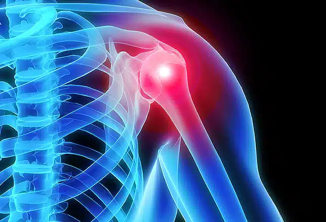 Shoulder Pain Chiropractor Near Me